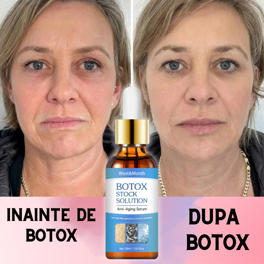 Ser Anti Rid Cu Efect de Botox - 30ml