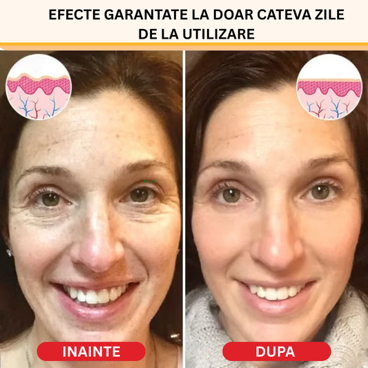 Ser Anti Rid Cu Efect de Botox